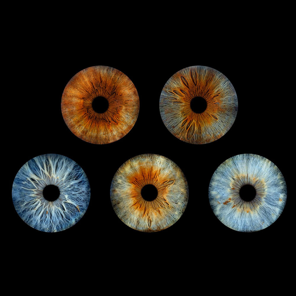 slika 5 oka zenica iris srbija